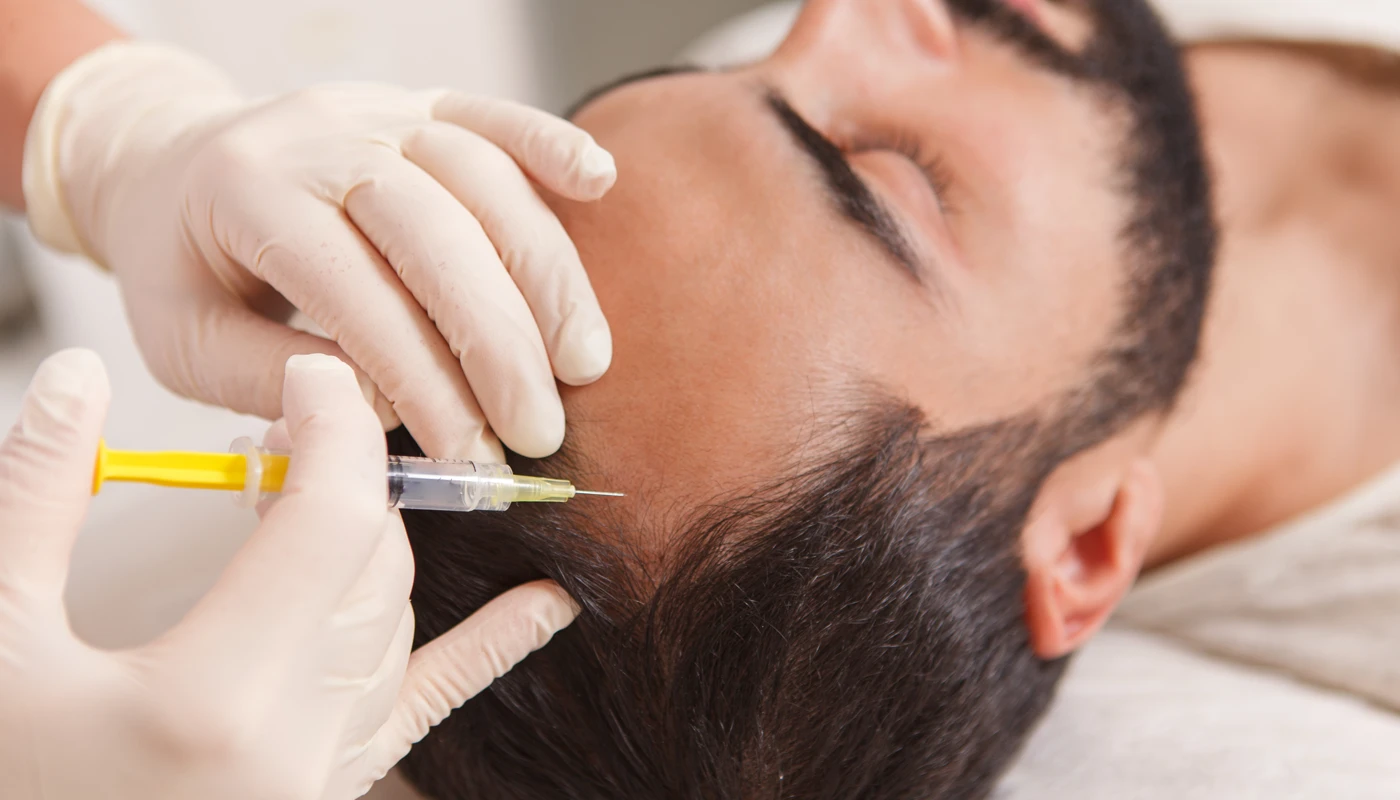 Mesoterapia Capilar en MODERMA by Sofía Garzón