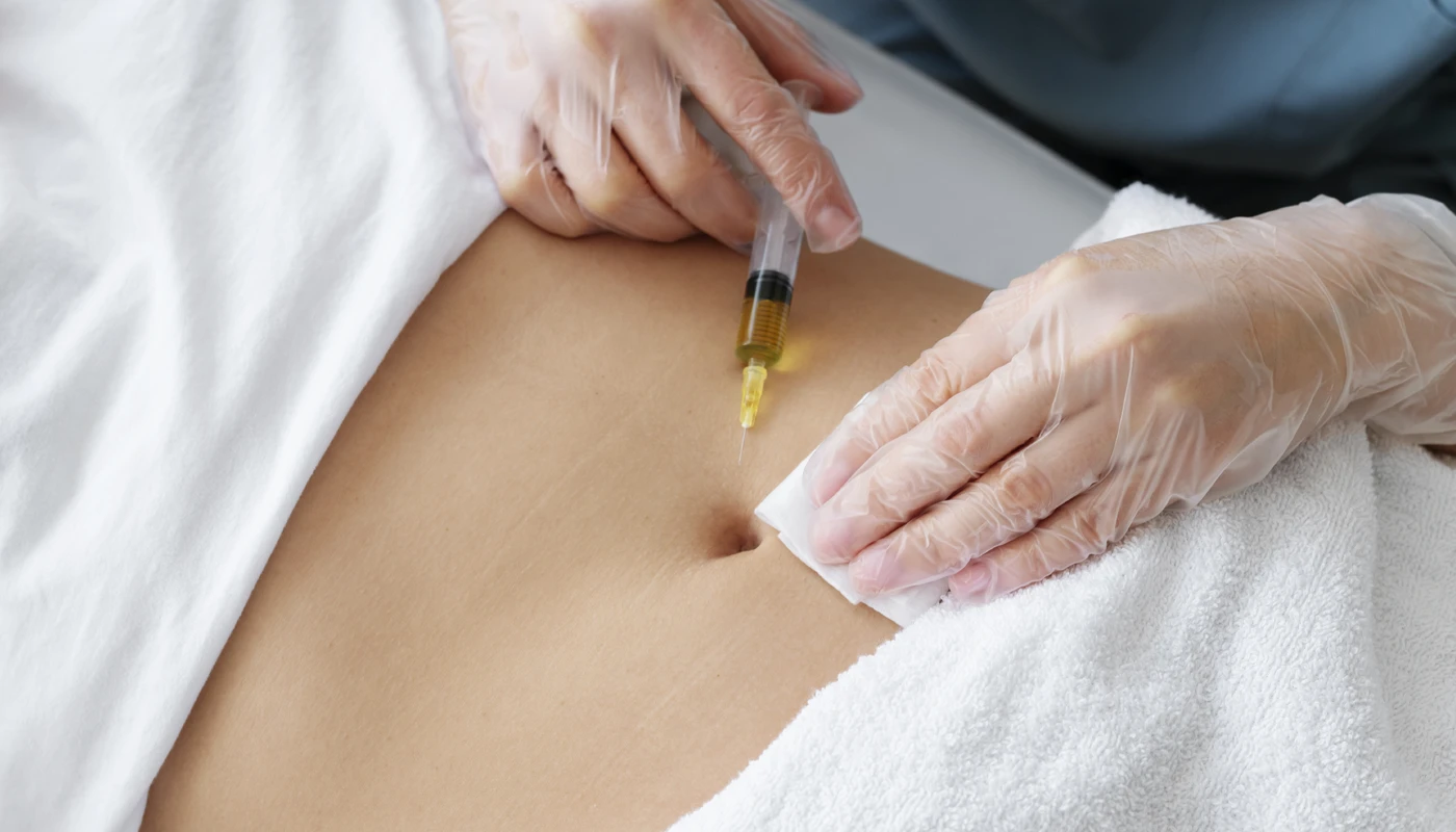 Mesoterapia Corporal en MODERMA by Sofía Garzón